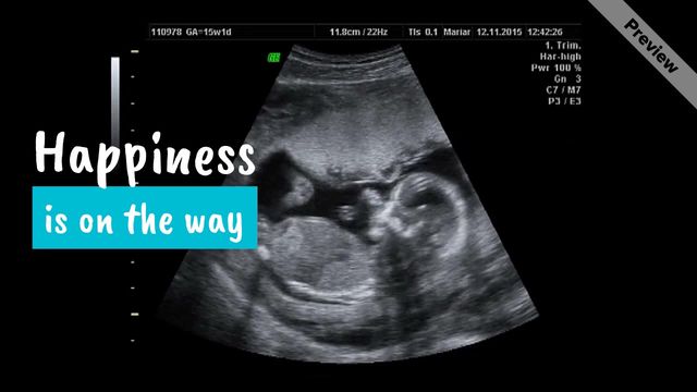 On the Way Video Template